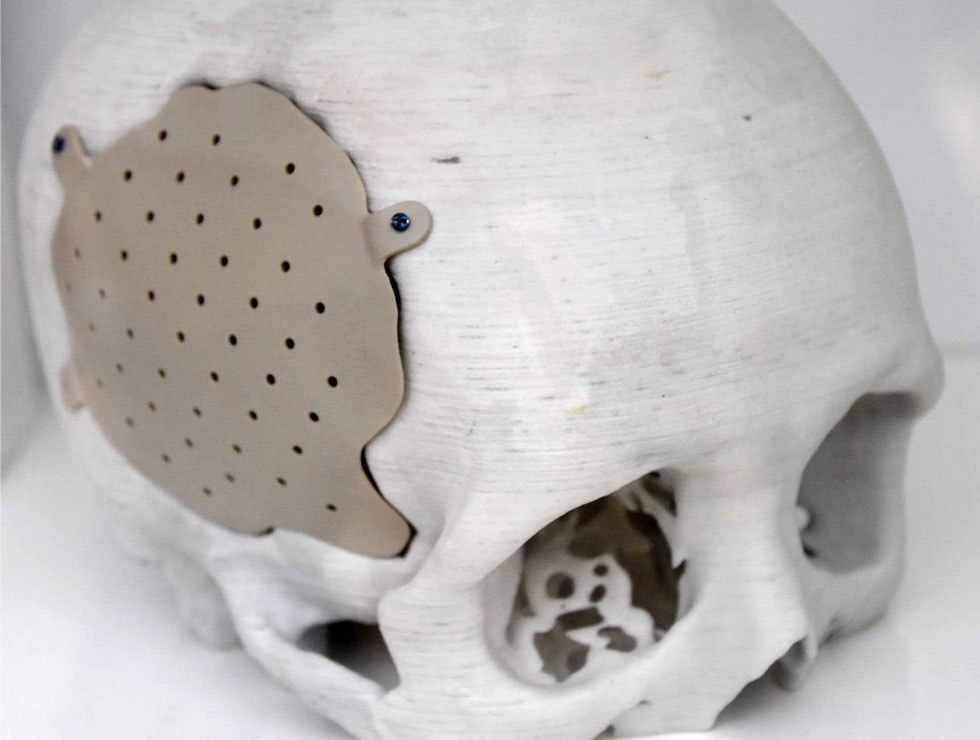 �@������ɫ�ĸ�ˎ��������Ŀ��������3D��ӡ���XĤ��